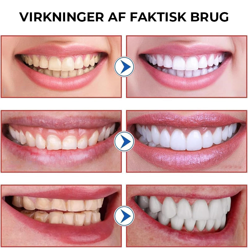 SP-8/SP-10 Probiotisk Hvidgørende Tandpasta til Mundhygiejne
