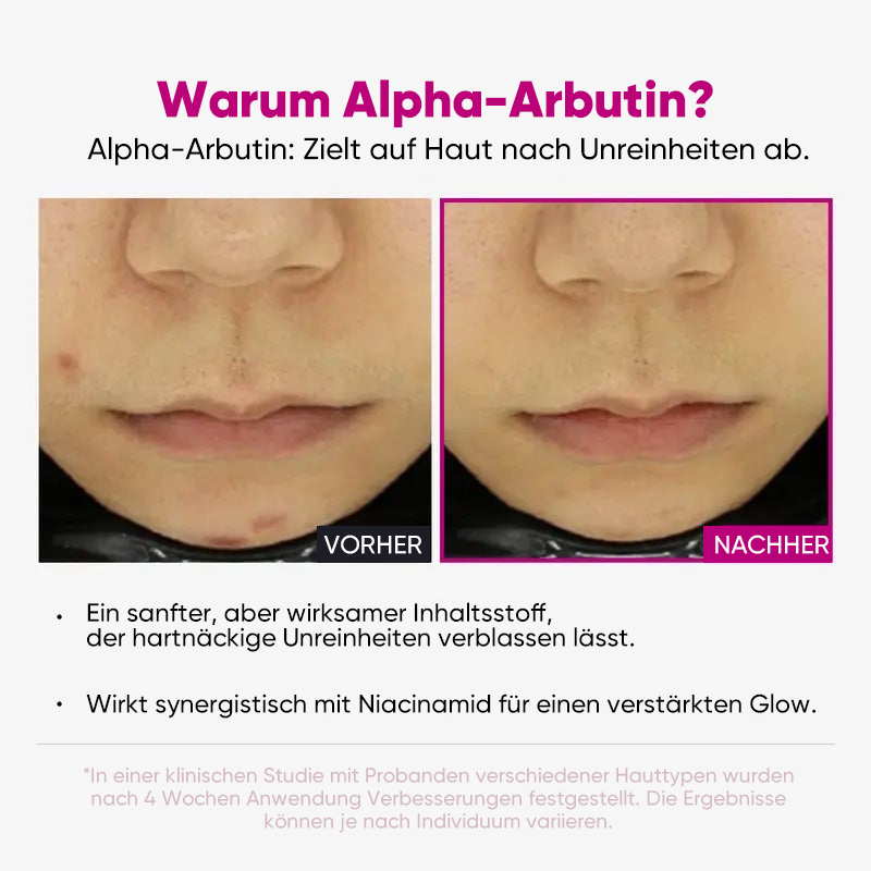 Intensives Aufhellungsserum