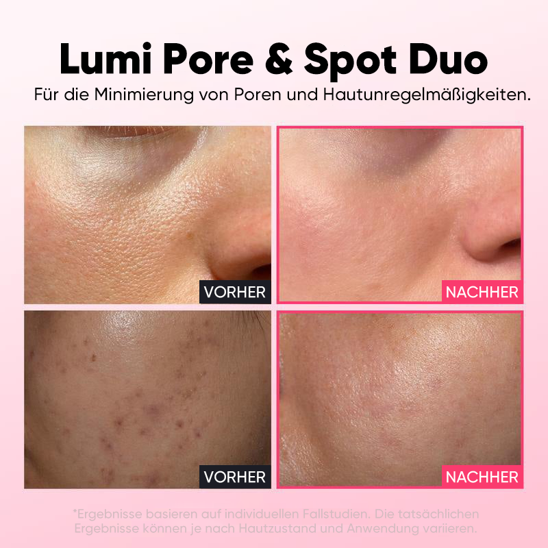 Intensives Aufhellungsserum