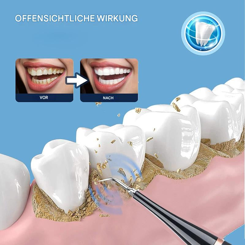 Elektrischer Ultraschall-Zahnbürste