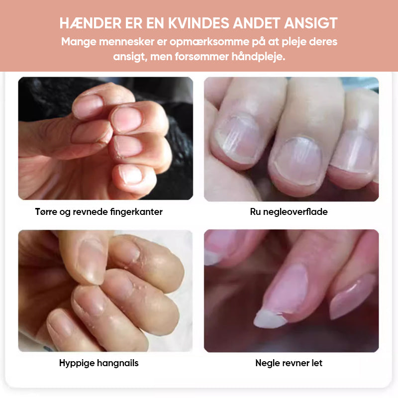 Negle Ernæringsmæssig Vækstolie