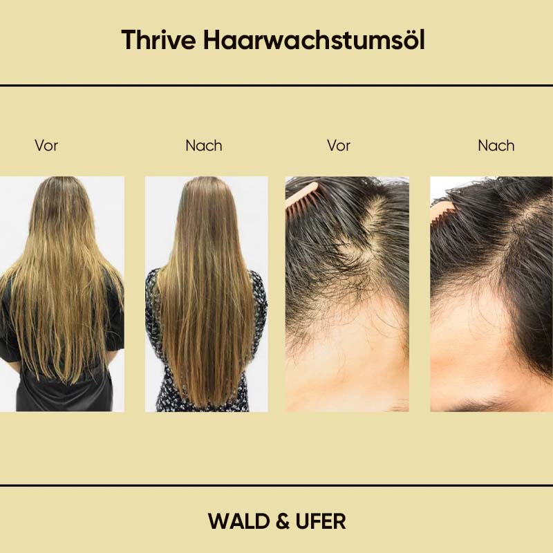 Natürliches Haarwachstumsöl