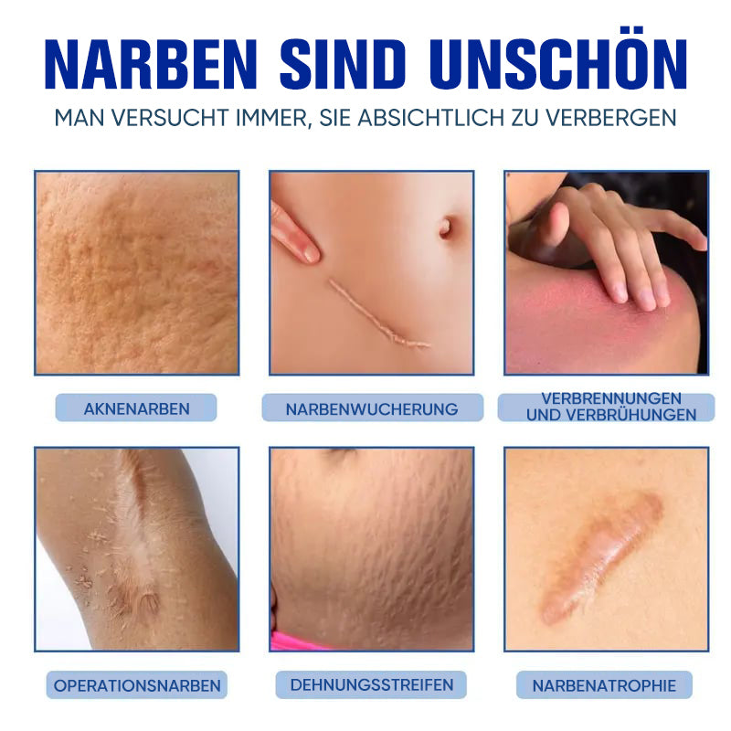 Professionelles Narbenentfernungsgel