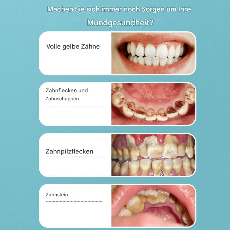 Elektrischer Ultraschall-Zahnbürste