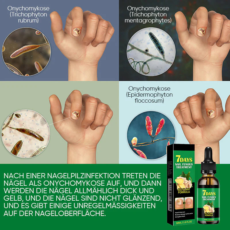 Ingwer-Nagelpflegelösung