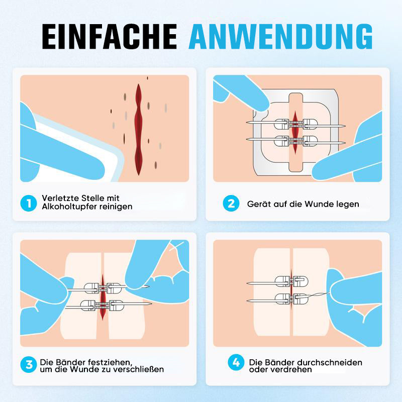 Wundverschlussstreifen ohne Nähen