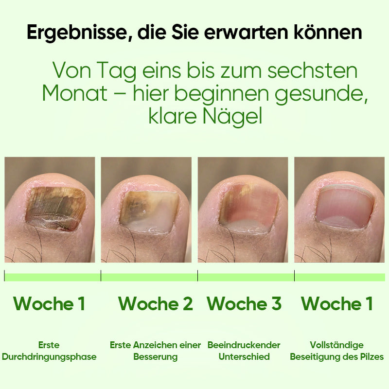Nagelpilzpflaster (21 Stück/Karton)