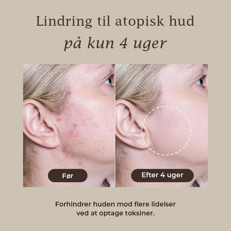Relief mudder maske