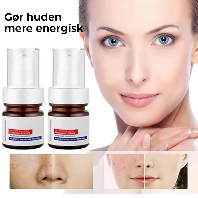 Vitamin C Hvidende Fregneansigtscreme