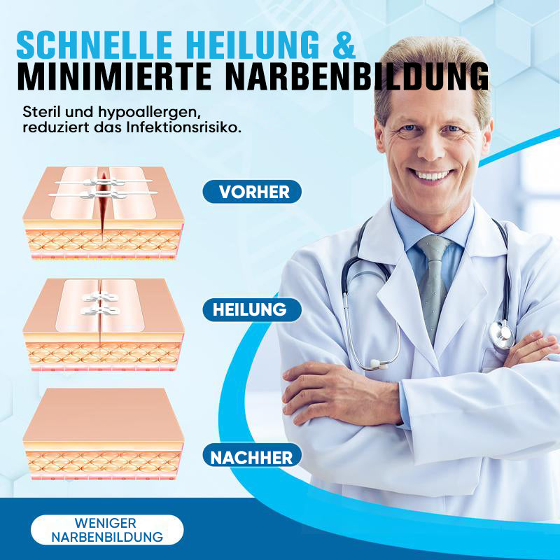 Wundverschlussstreifen ohne Nähen