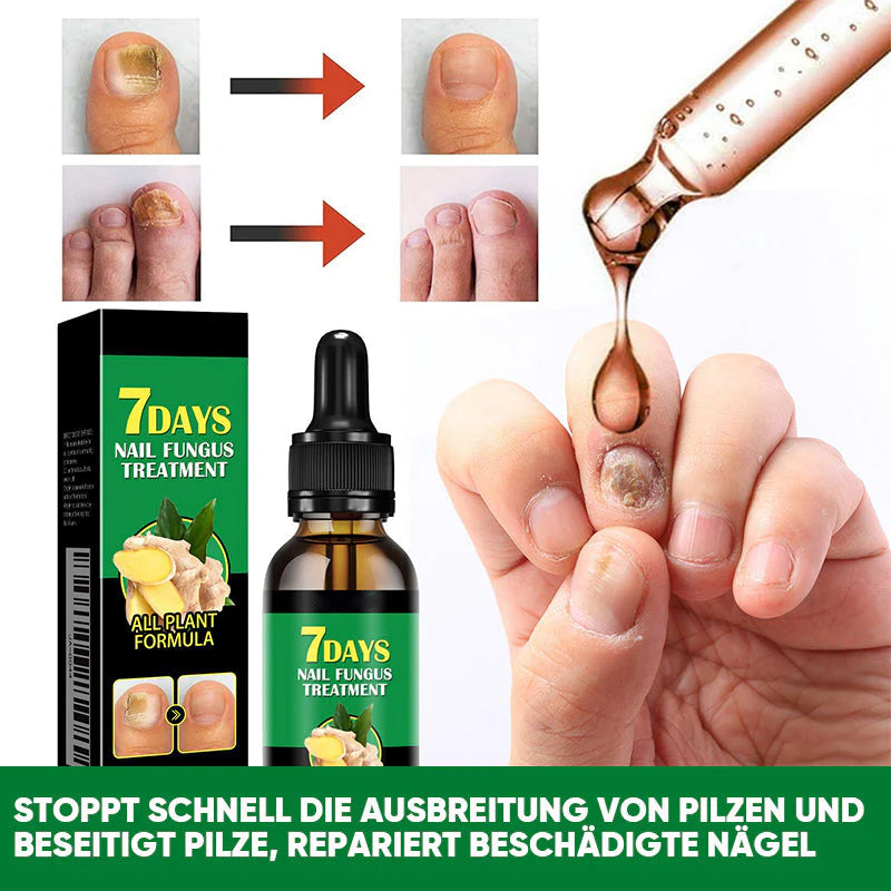 Ingwer-Nagelpflegelösung
