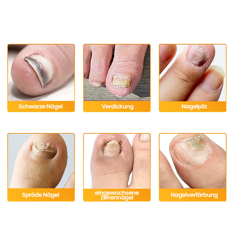 Ultradünne Nagelpilz-Sticker