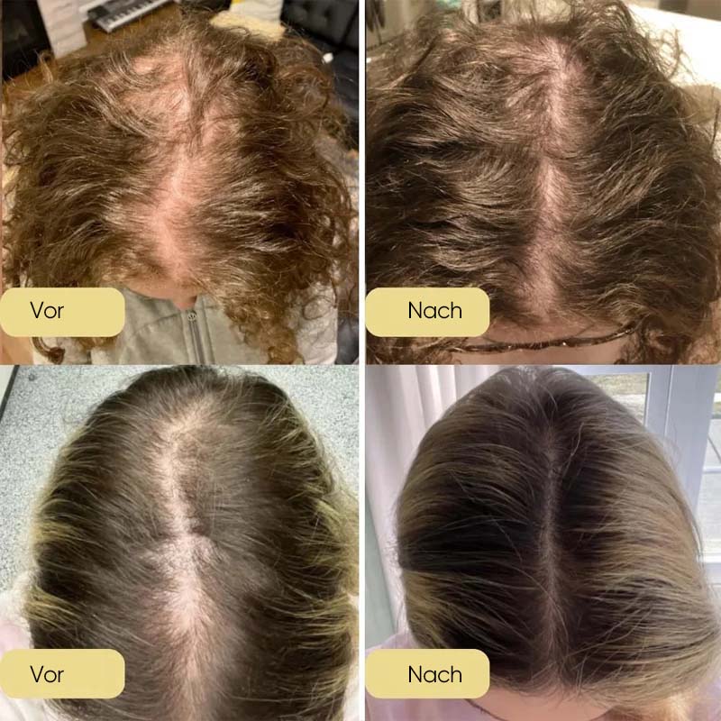 Natürliches Haarwachstumsöl
