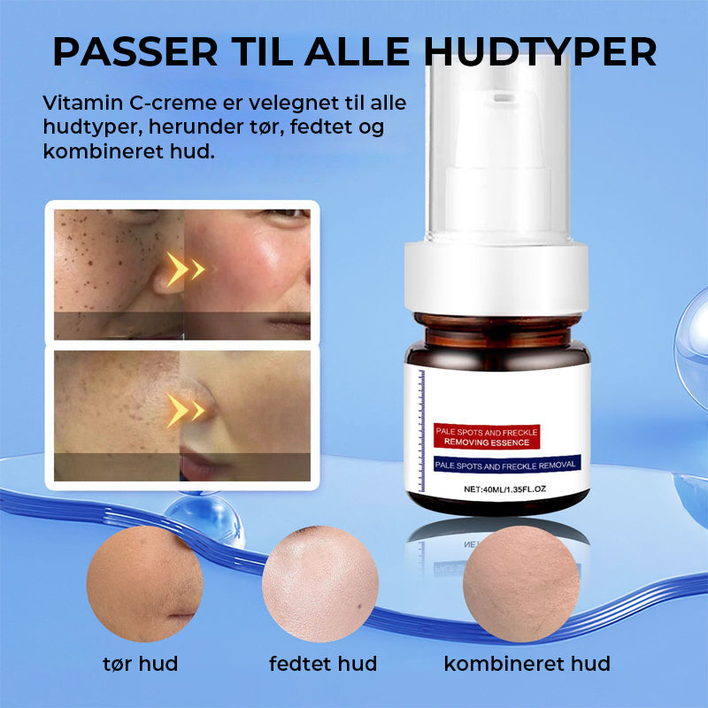 Vitamin C Hvidende Fregneansigtscreme