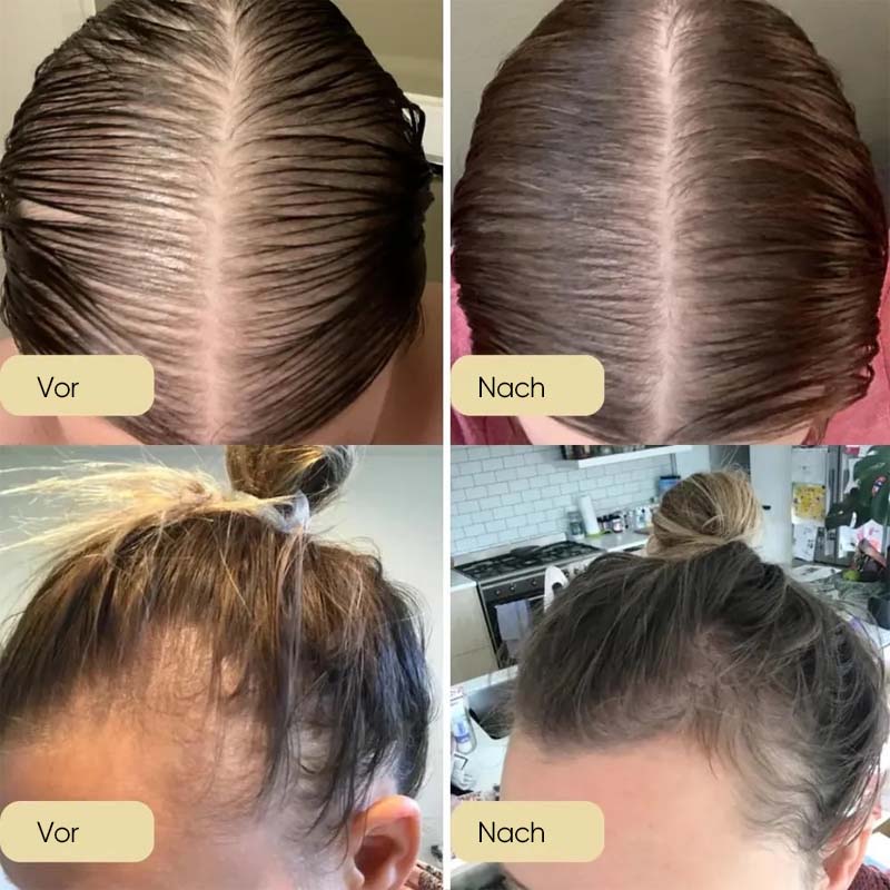 Natürliches Haarwachstumsöl