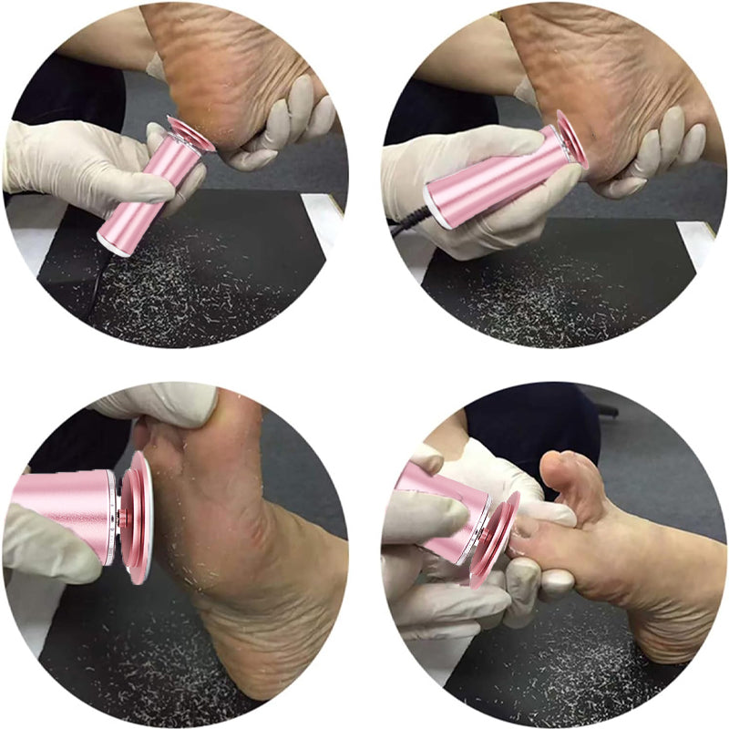 Elektrischer Hornhautentferner für die Füße