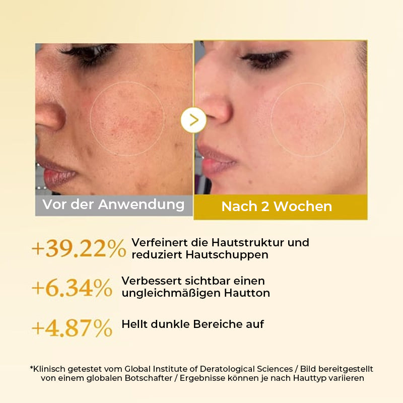 Kojisäure-Kurkuma-Toner für Gesicht und Körper