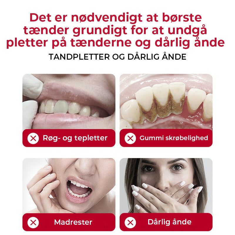 SP-8/SP-10 Probiotisk Hvidgørende Tandpasta til Mundhygiejne