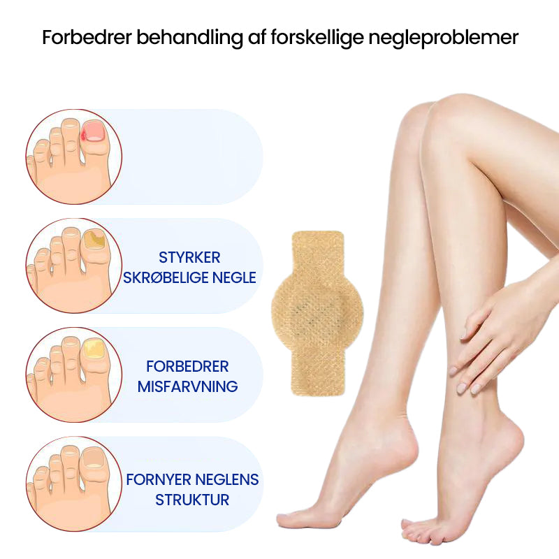 Svampeplastre til negle
