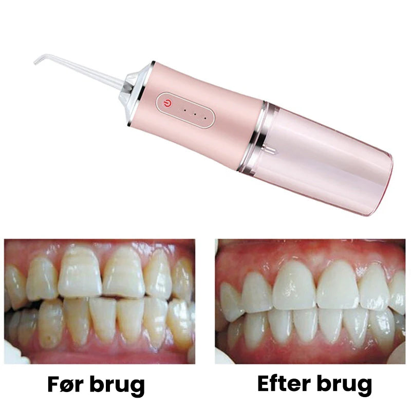 Bærbar dental vandtråd