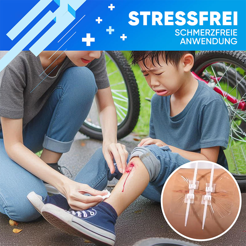 Wundverschlussstreifen ohne Nähen