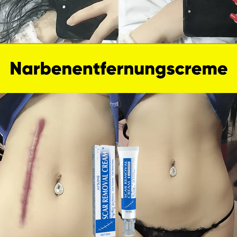 Professionelles Narbenentfernungsgel